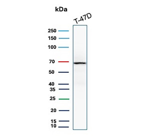 ER-A Antibody Recombinant Rabbit MAb T-47D WB. Western blot analysis of human T-47D cell lysate using Estrogen Receptor alpha antibody (clone ESR1/8407R) detects a band at approximately 65-70 kDa, consistent with the predicted molecular weight of Estrogen receptor alpha (ESR1), a nuclear hormone receptor expressed in hormone-responsive breast cancer cells; detection was performed with clone ESR1/8407R.