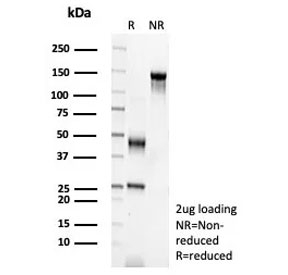 SDS-PAGE analysis of purified, BSA-free Epidermal Growth Factor Receptor antibody (clone EGFR/8933R) as confirmation of integrity and purity.