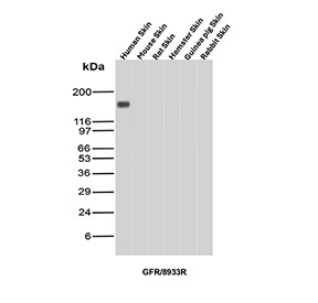 Western blot analysis of skin tissue lysates from multiple species using EGFR/Epidermal Growth Factor Receptor antibody (clone EGFR/8933R). A prominent band is detected in human skin at approximately 170-180 kDa, consistent with the predicted molecular weight of full-length Epidermal growth factor receptor and its commonly observed apparent migration on SDS-PAGE.