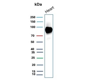 Western blot testing of human heart tissue lysate with CD36 Antibody Mouse Monoclonal CD36/7218. Expected molecular weight: 53-88 kDa depending on level of glycosylation.