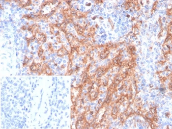 CD36 Antibody Mouse Monoclonal CD36/7218 IHC staining of FFPE human spleen tissue. The mouse monoclonal antibody (clone CD36/7218) demonstrates prominent membranous HRP-DAB brown staining in splenic macrophages and sinusoidal endothelial cells, consistent with Platelet glycoprotein 4 / CD36 expression, while most lymphoid cells show minimal staining. The antibody was applied at 2ug/ml. The inset shows PBS used in place of the primary antibody as a secondary-only negative control. Heat-induced epitope retrieval was performed in 10mM Tris with 1mM EDTA, pH 9.0, at 95oC for 20 minutes followed by cooling before testing.