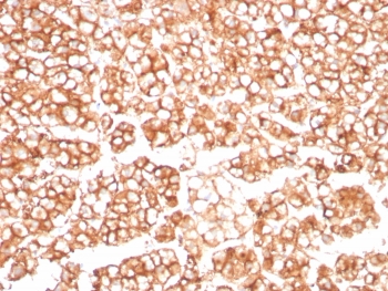 Immunohistochemistry analysis of P-glycoprotein / MDR1 antibody in human adrenal gland. FFPE human adrenal gland tissue was stained with P-glycoprotein / MDR1 antibody (clone MDR1/8962R). HRP-DAB brown chromogenic signal is observed predominantly along the plasma membrane of adrenal cortical cells, producing a distinct membranous staining pattern consistent with the expected localization of the ABCB1 drug efflux transporter. Cortical cells display strong circumferential membrane staining, while surrounding stromal components show minimal background signal. Nuclei are counterstained blue. Heat-induced epitope retrieval was performed by boiling tissue sections in 10 mM Tris with 1 mM EDTA, pH 9, for 20 minutes followed by cooling prior to antibody incubation.