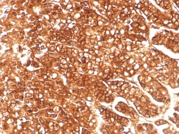 Immunohistochemistry analysis of ABCB1 / ATP-binding cassette sub-family B member 1 antibody in human adrenal gland. FFPE human adrenal gland tissue was stained with ABCB1 / ATP-binding cassette sub-family B member 1 antibody (clone MDR1/8986R). HRP-DAB brown chromogenic signal is observed predominantly along the plasma membrane of adrenal cortical cells, with strong membranous staining outlining cellular borders. Cytoplasmic staining is minimal, consistent with the expected membrane localization of the P-glycoprotein efflux transporter. The staining pattern highlights epithelial-like cortical cell populations, while surrounding stromal elements show limited background signal. Nuclei are counterstained blue. Heat-induced epitope retrieval was performed by boiling tissue sections in 10 mM Tris with 1 mM EDTA, pH 9, for 20 minutes followed by cooling prior to antibody incubation.