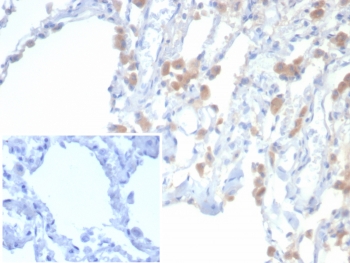 EPHB4 Antibody Human Lung IHC. Immunohistochemistry analysis of FFPE human lung tissue using EPHB4 Antibody (clone EPHB4/6392) demonstrates HRP-DAB brown membranous and cytoplasmic staining in epithelial and vascular-associated cells, consistent with Eph receptor B4 / EPHB4 expression as a receptor tyrosine kinase involved in cell signaling and vascular biology, while surrounding stromal elements show lower signal; nuclei are counterstained blue. Inset: PBS used in place of primary antibody shows minimal background staining, confirming specificity. HIER: boil tissue sections in pH 9 10 mM Tris with 1 mM EDTA for 20 min and allow to cool before testing.