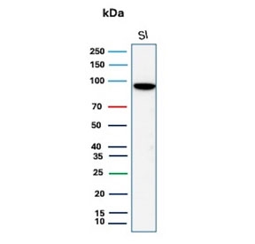 LI Cadherin Antibody WB. Western blot analysis of human small intestine tissue lysate using LI Cadherin Antibody / CDH17 Antibody (recombinant mouse monoclonal clone rCDH17/8514) demonstrates a strong immunoreactive band at approximately 100-110 kDa, consistent with expression of Cadherin 17 (CDH17, LI-cadherin). CDH17 is a calcium-dependent cell adhesion molecule predominantly expressed in gastrointestinal epithelial tissues, where it contributes to epithelial organization, maintenance of tissue integrity, and regulation of cell-cell interactions. The observed molecular weight is higher than the predicted size of approximately 92 kDa, a finding commonly attributed to extensive glycosylation of the extracellular domain. Such post-translational modification frequently results in slower electrophoretic migration and an increased apparent molecular weight during western blot analysis. The observed banding pattern is consistent with expected glycosylated CDH17 expression in human small intestinal epithelium. Predicted molecular weight: approximately 92 kDa.