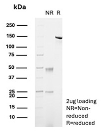 Carboxypeptidase A1 Antibody SDS-PAGE Analysis. SDS-PAGE analysis of recombinant mouse monoclonal Carboxypeptidase A1 antibody, clone rCPA1/8689, under non-reducing (NR) and reducing (R) conditions. Under non-reducing conditions, the intact antibody migrates as a single band at approximately 150 kDa, consistent with full IgG structure, while reducing conditions resolve the antibody into heavy chain (~50 kDa) and light chain (~25 kDa) bands. This pattern confirms expected antibody integrity and disulfide bond-dependent structure.