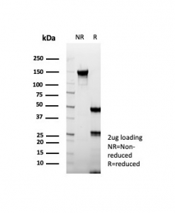 SDS-PAGE analysis of purified, BSA-free Carboxypeptidase A1 antibody (clone rCPA1/8518) as confirmation of integrity and purity.