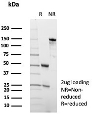 SDS-PAGE analysis of purified, BSA-free ADCY8 antibody (clone ADCY8/7573) as confirmation of integrity and purity.