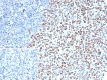 EZH2 Antibody Tonsil Tissue Immunohistochemistry. IHC staining of FFPE human tonsil tissue with EZH2 antibody (clone EZH2/6991). Inset: PBS used in place of primary Ab (secondary Ab negative control). HIER: boil tissue sections in pH 9 10mM Tris with 1mM EDTA for 20 min and allow to cool before testing.
