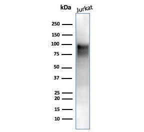 Enhancer of zeste homolog 2 Antibody WB. Western blot testing of human Jurkat cell lysate with Enhancer of zeste homolog 2 antibody (clone EZH2/6988). Expected molecular weight: 85-95 kDa.