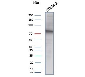EZH2 Antibody HDLM-2 Cell WB. Western blot testing of human HDLM-2 cell lysate with EZH2 antibody (clone EZH2/7507). Predicted molecular weight: 85-95 kDa.