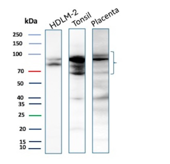 EZH2 Antibody Tissue and Cell Line WB. Western blot analysis of HDLM-2, human tonsil, and human placenta lysates using EZH2 / KMT6 recombinant mouse monoclonal antibody detects prominent bands within the approximately 70-100 kDa range, consistent with reported EZH2 expression and the commonly observed heterogeneous migration pattern of this chromatin-associated histone methyltransferase. Multiple closely migrating bands and broad signal distribution may reflect post-translational modification, including phosphorylation, as well as heterogeneous chromatin-associated forms of EZH2; detection was performed with clone EZH2/7507.