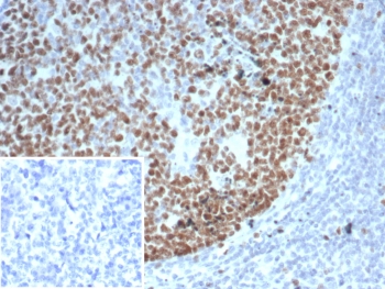 EZH2 Antibody Human Tonsil Germinal Center IHC. Immunohistochemistry staining of FFPE human tonsil tissue with EZH2 antibody (clone EZH2/6989). Inset: PBS used in place of primary Ab (secondary Ab negative control). HIER: boil tissue sections in pH 9 10mM Tris with 1mM EDTA for 20 min and allow to cool before testing.