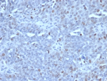 EZH2 Antibody Human Tonsil Lymphocyte IHC. Immunohistochemistry testing of FFPE human tonsil tissue with EZH2 antibody (clone EZH2/6989). HIER: boil tissue sections in pH 9 10mM Tris with 1mM EDTA for 20 min and allow to cool before testing.