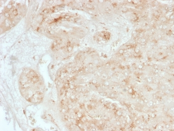 StAR Antibody Steroidogenic Cell Marker (clone STAR/3976). Immunohistochemistry analysis of Steroidogenic Acute Regulatory Protein (StAR / STARD1) in FFPE human adrenal gland tissue using a mouse monoclonal antibody. HRP-DAB brown cytoplasmic staining highlights steroidogenic cells of the adrenal cortex, consistent with the mitochondrial localization of StAR in steroid hormone-producing endocrine cells, while the adrenal medulla and surrounding non-steroidogenic tissues show minimal staining. Heat-induced epitope retrieval was performed by boiling tissue sections in pH 9 Tris-EDTA buffer (10 mM Tris with 1 mM EDTA) for 20 minutes followed by cooling prior to antibody staining.