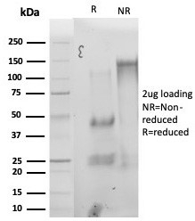 SDS-PAGE analysis of purified, BSA-free StAR Antibody Steroidogenic Cell Marker (clone STAR/3976) as confirmation of integrity and purity.