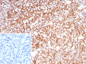 Clusterin Antibody Tonsil IHC. Immunohistochemistry analysis of FFPE human tonsil tissue using Clusterin antibody. The recombinant rabbit monoclonal antibody clone CLU/8865R demonstrates strong cytoplasmic and extracellular staining within lymphoid regions, consistent with Clusterin / CLU expression as a secreted chaperone protein marker. Signal is prominent in lymphoid cell populations and surrounding microenvironment, reflecting extracellular accumulation of this glycoprotein, while background staining remains low. A PBS-only control confirms minimal non-specific staining. HIER: boil tissue sections in 10 mM Tris with 1 mM EDTA, pH 9, for 20 min followed by cooling prior to staining.