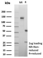 SDS-PAGE analysis of purified, BSA-free Carbonic Anhydrase VIII antibody (clone CA8/8605R) as confirmation of integrity and purity.