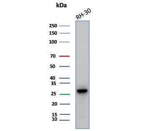 Western blot testing of human RH-30 cell lysate with Carbonic Anhydrase 3 antibody (clone CA3/7883). Predicted molecular weight ~29 kDa.