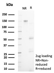 SDS-PAGE analysis of purified, BSA-free N-terminal EF-hand calcium binding protein 1 antibody (clone NECAB1/7676) as confirmation of integrity and purity.