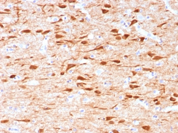IHC staining of FFPE human brain tissue with NECAB1 antibody (clone NECAB1/7677). HIER: boil tissue sections in pH 9 10mM Tris with 1mM EDTA for 20 min and allow to cool before testing.