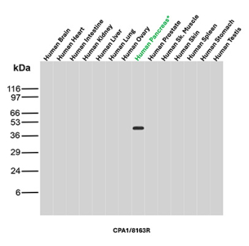 Carboxypeptidase A1 Antibody Tissue Panel WB. Western blot analysis of Carboxypeptidase A1 / CPA1 across human tissue lysates including brain, heart, intestine, kidney, liver, lung, ovary, pancreas, prostate, skeletal muscle, skin, spleen, stomach, and testis using rabbit monoclonal Carboxypeptidase A1 antibody, clone CPA1/8163R. A distinct band is detected at approximately 45 kDa exclusively in the pancreas lane, consistent with the predicted molecular weight of CPA1, demonstrating its highly restricted expression and supporting its use as a pancreatic acinar cell marker in tissue analysis.