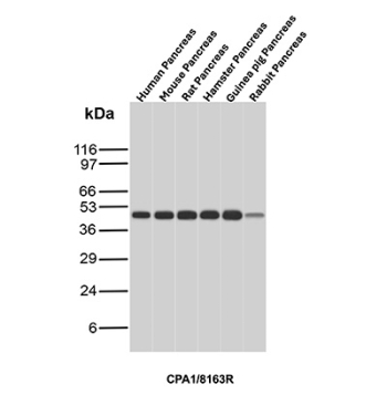Carboxypeptidase A1 Antibody Pancreas Multi-Species WB. Western blot analysis of Carboxypeptidase A1 / CPA1 across pancreas tissue lysates from human, mouse, rat, hamster, guinea pig, and rabbit using rabbit monoclonal Carboxypeptidase A1 antibody, clone CPA1/8163R. A band is detected at approximately 45 kDa in each species, consistent with the predicted molecular weight of CPA1, demonstrating conserved expression of this digestive enzyme and reinforcing its role as a pancreatic acinar cell marker across mammalian species.