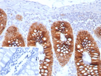 Immunohistochemistry of Cadherin 17 antibody in human colon tissue. The recombinant rabbit mAb clone CDH17/8513R demonstrates strong membranous HRP-DAB brown staining along the lateral borders of colonic epithelial cells, consistent with Cadherin 17 localization in intestinal epithelium. Staining highlights well-organized glandular crypt structures with preserved epithelial polarity, while surrounding stromal tissue shows minimal background signal. The negative control inset, using PBS in place of the primary antibody, shows no specific staining. Heat-induced epitope retrieval was performed by boiling tissue sections in pH 9 10mM Tris with 1mM EDTA for 20 minutes followed by cooling prior to incubation.