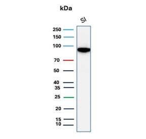Western blot testing of human small intestine lysate with Cadherin 17 antibody recombinant rabbit mAb (clone CDH17/8513R). Predicted molecular weight ~92 kDa but may be observed at higher molecular weights due to glycosylation.