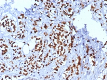 TRPS1 Antibody immunohistochemistry analysis in human breast tissue. FFPE human breast tissue stained with TRPS1 antibody shows strong nuclear staining in epithelial cells, consistent with TRPS1 localization as a transcription factor. A recombinant rabbit monoclonal antibody (clone TRPS1/8008R) was used for detection. Antigen retrieval was performed using pH 9 Tris-EDTA buffer with heat-induced epitope retrieval, and hematoxylin counterstain highlights nuclei (blue).