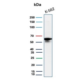 Western blot testing of human K562 cell lysate with c-Myc antibody. Theoretical molecular weight: ~50 kDa but routinely observed at 50~70 kDa.