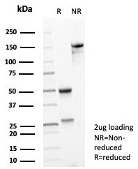 SDS-PAGE analysis of purified, BSA-free NTRK2 antibody (clone NTRK2/4672) as confirmation of integrity and purity.