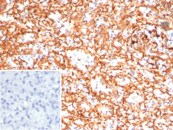 IHC staining of FFPE human spleen tissue with Adenylyl cyclase 8 antibody (clone ADCY8/7574). HIER: boil tissue sections in pH 9 10mM Tris with 1mM EDTA for 20 min and allow to cool before testing.