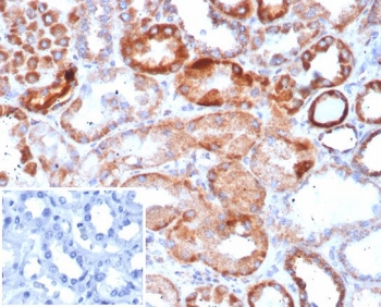 IHC staining of FFPE human kidney tissue with Carbonic Anhydrase IX antibody (clone CA9/4019). Inset: PBS used in place of primary Ab (secondary Ab negative control). HIER: boil tissue sections in pH 9 10mM Tris with 1mM EDTA for 20 min and allow to cool before testing.