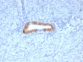 P16INK4a Antibody HeLa WB. Western blot analysis of Cyclin-dependent kinase inhibitor 2A (p16INK4a) expression in HeLa cell lysate using P16INK4a antibody clone rCDKN2/8062. Lane 1: HeLa cell lysate. A band is detected at approximately 15â17 kDa, consistent with the predicted molecular weight of p16INK4a, a cyclin-dependent kinase inhibitor that regulates G1 cell cycle progression through inhibition of CDK4 and CDK6. The clear signal supports the use of this clone for western blot analysis of proliferating cell lines.