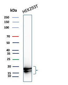 P16INK4a Antibody HEK293T WB. Western blot analysis of Cyclin-dependent kinase inhibitor 2A (p16INK4a) expression in HEK293T cell lysate using P16INK4a antibody clone CDKN2A/8223R. Lane 1: HEK293T cell lysate. Bands are detected at approximately 15â17 kDa, consistent with the predicted molecular weight of p16INK4a, a cyclin-dependent kinase inhibitor that regulates G1 cell cycle progression through inhibition of CDK4 and CDK6. The presence of multiple closely migrating bands may reflect isoforms, post-translational modification, or minor proteolytic processing.