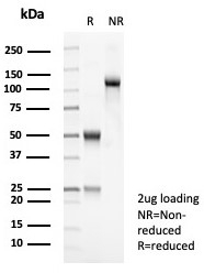 SDS-PAGE analysis of purified, BSA-free Tyrosinase-Related Protein-1 antibody (clone TYRP1/8313R) as confirmation of integrity and purity.
