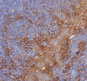 IHC staining of FFPE human tonsil tissue with PD-L1 antibody (clone PDL1/8222R). HIER: boil tissue sections in pH 9 10mM Tris with 1mM EDTA for 20 min and allow to cool before testing.