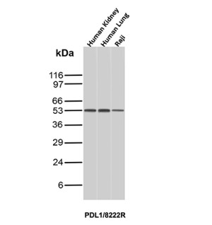 PD-L1 Antibody PDL1/8222R in Human Tissues and Raji Cells WB. Western blot testing of PD-L1 Antibody PDL1/8222R / CD274 in human kidney, human lung and Raji B lymphocyte cell lysates. A prominent band is observed at approximately 50 kDa across the tested samples, above the predicted molecular weight of ~33 kDa for unmodified PD-L1/CD274. The higher apparent molecular weight is consistent with the established N-linked glycosylation of mature PD-L1. This PD-L1 Antibody demonstrates detection of glycosylated CD274 in human tissue and cell lysates.
