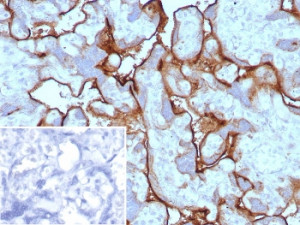 Immunohistochemistry analysis of PD-L1 antibody in human placenta. PD-L1 Antibody Rabbit Monoclonal PDL1/8591R was used for immunohistochemistry on FFPE human placental tissue. Distinct HRP-DAB brown membranous staining is observed along the trophoblastic epithelial layer of chorionic villi, consistent with the known surface localization of Programmed death-ligand 1 (PD-L1 / CD274), an immune checkpoint ligand that contributes to regulation of maternal-fetal immune tolerance. The staining outlines the syncytiotrophoblast and cytotrophoblast layers surrounding villous structures, while underlying stromal components show minimal signal. The rabbit monoclonal antibody clone PDL1/8591R detects PD-L1 expression in placental trophoblastic epithelium within the villous architecture. Inset: PBS used in place of primary antibody as a secondary antibody negative control. HIER: boil tissue sections in pH 9 10mM Tris with 1mM EDTA for 20 min and allow to cool before testing.