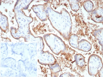 Immunohistochemistry analysis of B7-H1 antibody in human placenta. B7-H1 Antibody Recombinant Rabbit MAb PDL1/8809R was used for immunohistochemistry on FFPE human placental tissue. HRP-DAB brown membranous staining is observed in trophoblastic epithelial cells lining chorionic villi, consistent with the known cell surface localization of Programmed death-ligand 1 (PD-L1 / CD274), an immune checkpoint ligand involved in regulation of maternal-fetal immune tolerance. The staining highlights the trophoblastic layer surrounding placental villous structures, while underlying stromal components show minimal signal. The recombinant rabbit monoclonal antibody (clone PDL1/8809R) detects PD-L1 expression in placental epithelial cells within the villous architecture. Inset: PBS used in place of primary antibody as a secondary antibody negative control. HIER: boil tissue sections in pH 9 10mM Tris with 1mM EDTA for 20 min and allow to cool before testing.