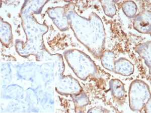 Immunohistochemistry analysis of B7-H1 antibody in human placenta. B7-H1 Antibody Recombinant Rabbit MAb PDL1/8809R was used for immunohistochemistry on FFPE human placental tissue. HRP-DAB brown membranous staining is observed in trophoblastic epithelial cells lining chorionic villi, consistent with the known cell surface localization of Programmed death-ligand 1 (PD-L1 / CD274), an immune checkpoint ligand involved in regulation of maternal-fetal immune tolerance. The staining highlights the trophoblastic layer surrounding placental villous structures, while underlying stromal components show minimal signal. The recombinant rabbit monoclonal antibody (clone PDL1/8809R) detects PD-L1 expression in placental epithelial cells within the villous architecture. Inset: PBS used in place of primary antibody as a secondary antibody negative control. HIER: boil tissue sections in pH 9 10mM Tris with 1mM EDTA for 20 min and allow to cool before testing.