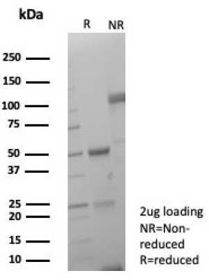 SDS-PAGE analysis of purified, BSA-free recombinant rabbit B7-H1 antibody (clone PDL1/8809R) as confirmation of integrity and purity.