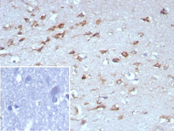 IHC staining of FFPE human brain tissue with Tropomyosin-related kinase B antibody (clone NTRK2/7926). Inset: PBS used in place of primary Ab (secondary Ab negative control). HIER: boil tissue sections in pH 9 10mM Tris with 1mM EDTA for 20 min and allow to cool before testing.