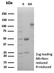 SDS-PAGE analysis of purified, BSA-free Pappalysin-1 antibody (clone PAPPA/8804R) as confirmation of integrity and purity.