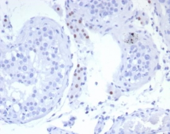 SF-1 Antibody Testis Immunohistochemistry. IHC staining of FFPE human testis tissue with SF-1 antibody (clone SF1/8150R). HIER: boil tissue sections in pH 9 10mM Tris with 1mM EDTA for 20 min and allow to cool before testing.