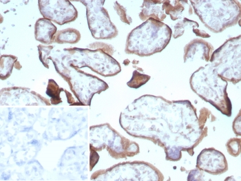 CD105 Antibody Placenta IHC. Immunohistochemistry staining of FFPE human placental tissue with Endoglin / CD105 antibody (clone ENG/8961R) Inset: PBS used in place of primary Ab (secondary Ab negative control). HIER: boil tissue sections in pH 9 10mM Tris with 1mM EDTA for 20 min and allow to cool before testing.