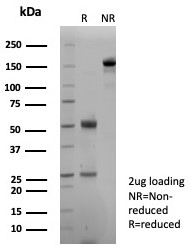 SDS-PAGE analysis of purified, BSA-free Pan-Cadherin antibody (clone Pan-CAD/8020) as confirmation of integrity and purity.