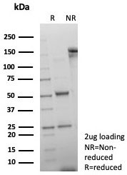 SDS-PAGE analysis of purified, BSA-free Double Stranded DNA antibody (clone rDSD/8266) as confirmation of integrity and purity.