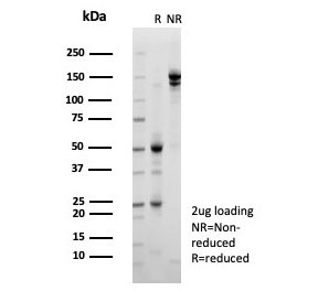 SDS-PAGE analysis of purified, BSA-free JARID1C antibody (clone PCRP-KDM5C-1A11) as confirmation of integrity and purity.